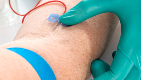 Erythropoietin Test