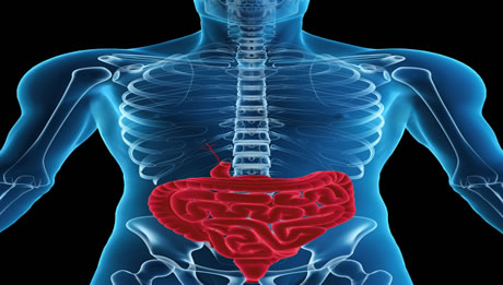 Colectomy