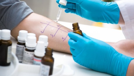 Allergy Skin Test - 460x261