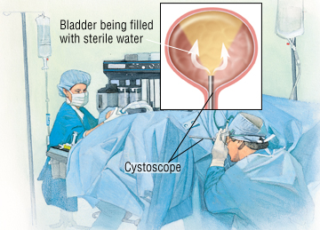bladder bladder