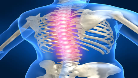 Vertebroplasty