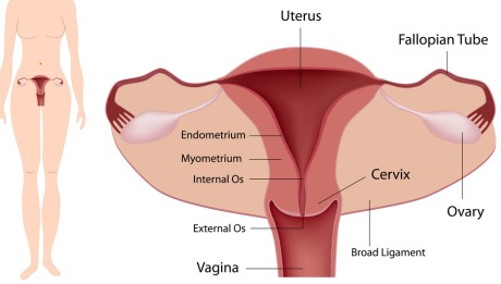Essure - 460x261