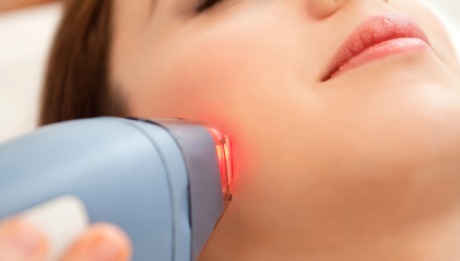 Laser Skin Resurfacing - 460x261