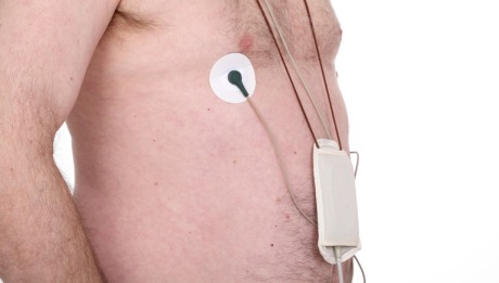 Holter Monitor