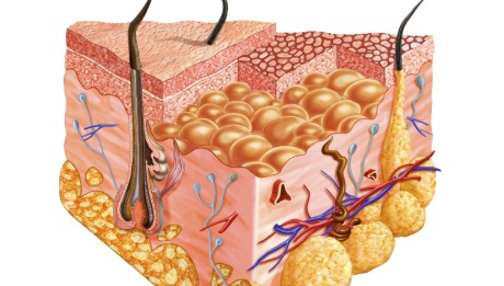 Skin Grafting
