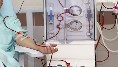 Dialysis