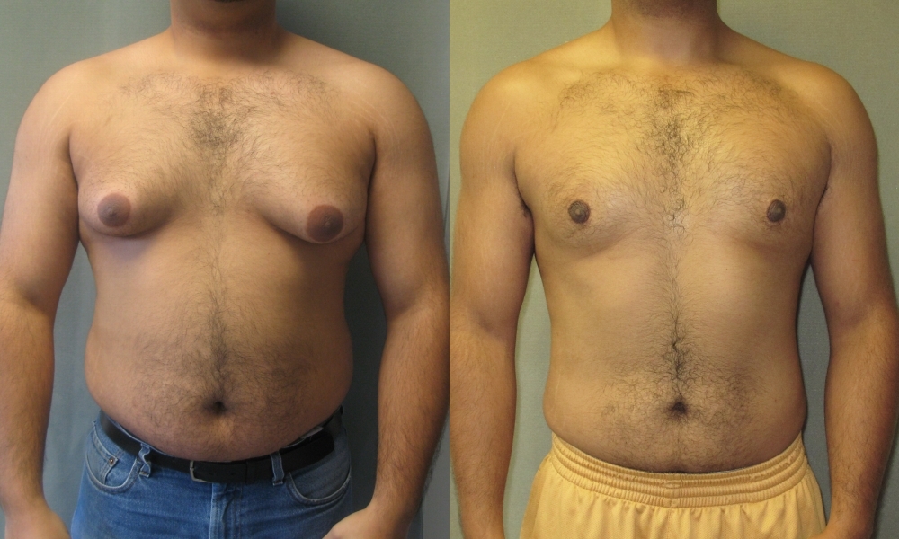 8 Myths About Cosmetic Surgery