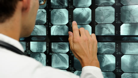 Coronary Angiography