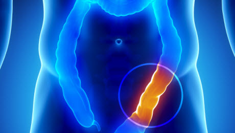 bowel obstruction repair