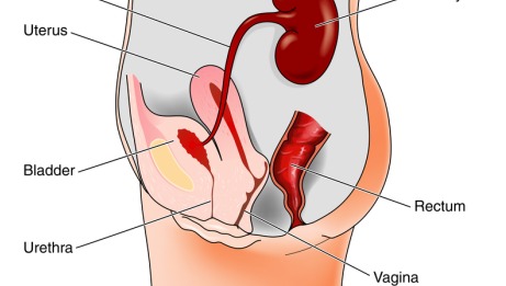 Incontinence Sling Procedure - 460x261