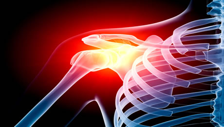 Shoulder Surgery