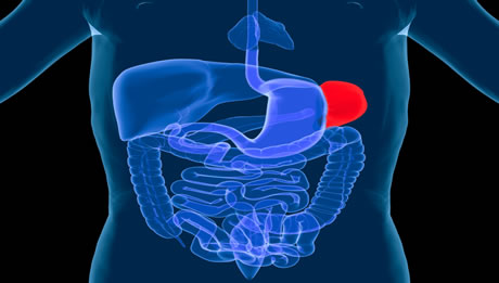 Splenectomy