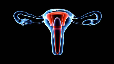 Uterine Ablation
