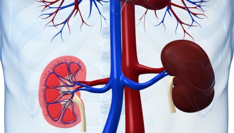 Kidney Transplant