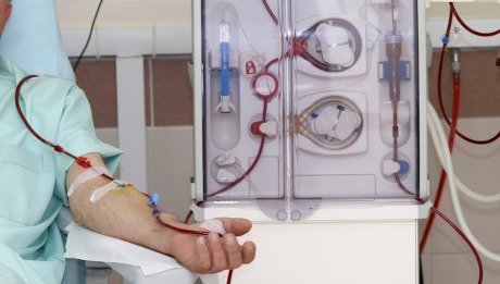 Arteriovenous (AV) Graft Surgery - 460x261