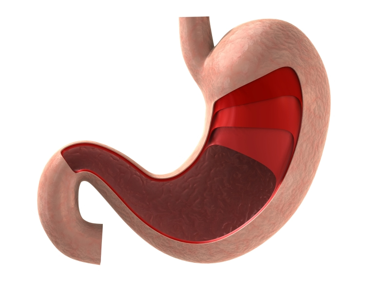 10 Common Digestive Disorders